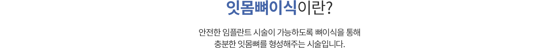 임플란트센터