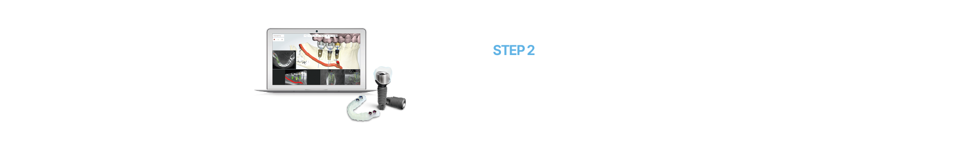 임플란트센터