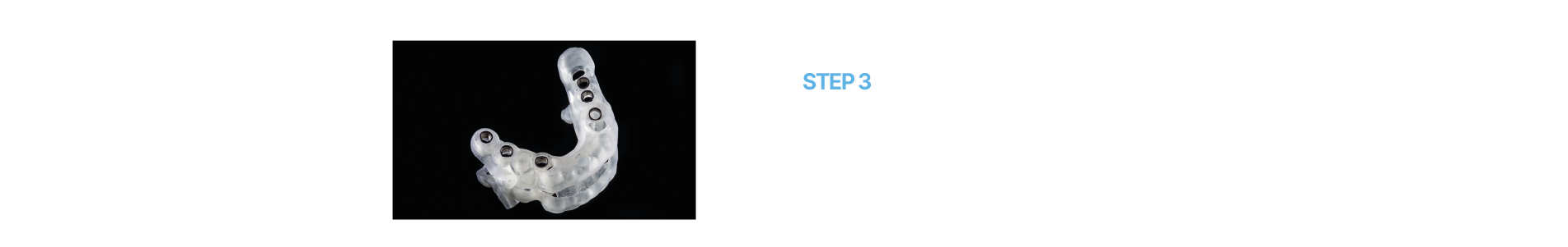 임플란트센터