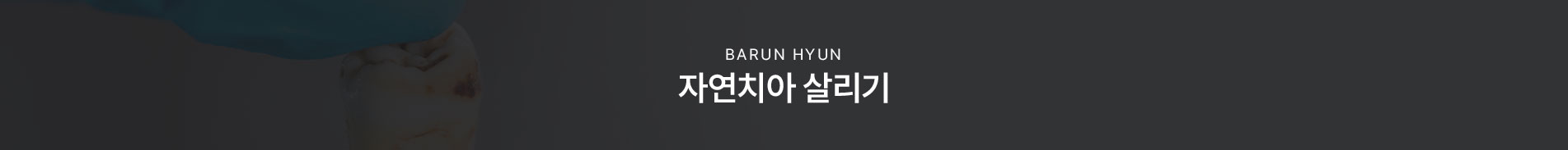 자연치아살리기